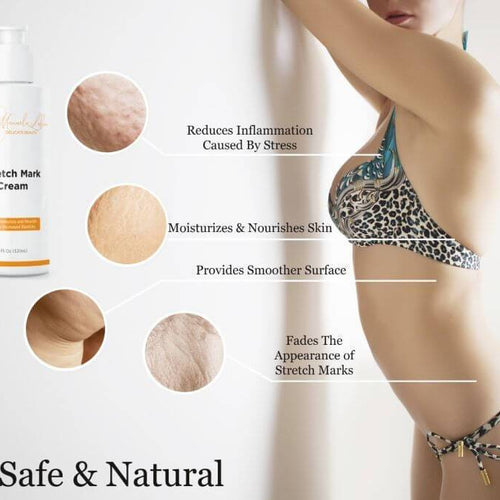 Load image into Gallery viewer, Advanced Stretch Mark Removal Cream
