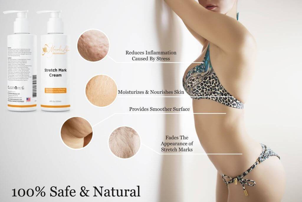 Advanced Stretch Mark Removal Cream